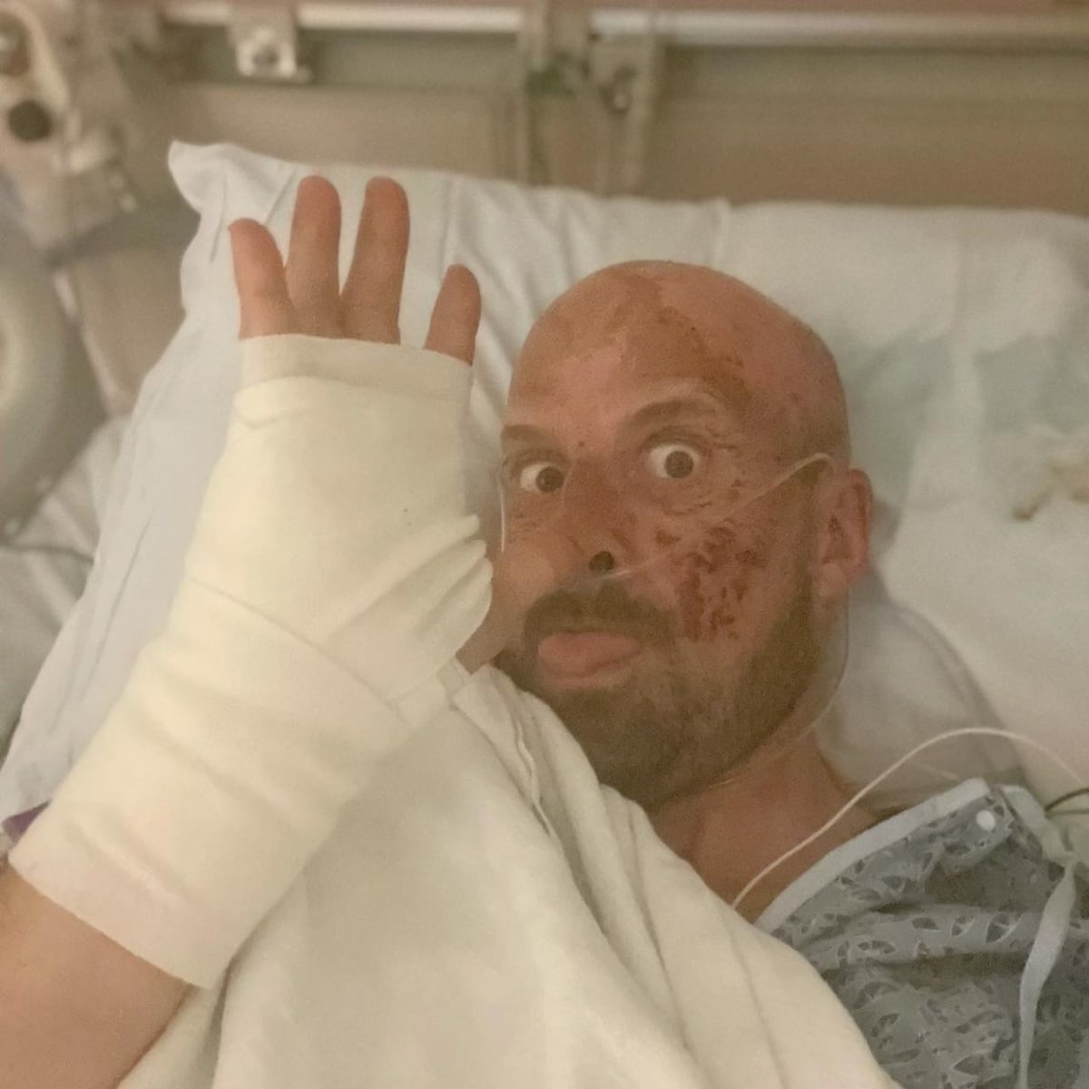 'AGT: Extreme' contestant Jonathan Goodwin files lawsuit against NBC after severe injury (Instagram/@jonathangoodwinofficial)